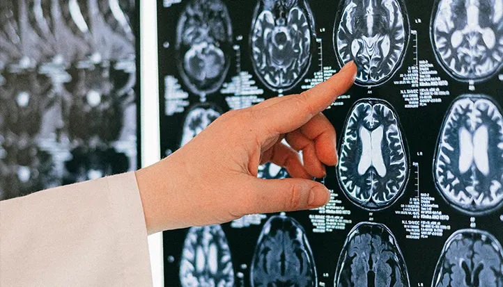 Traumatic Brain Injuries